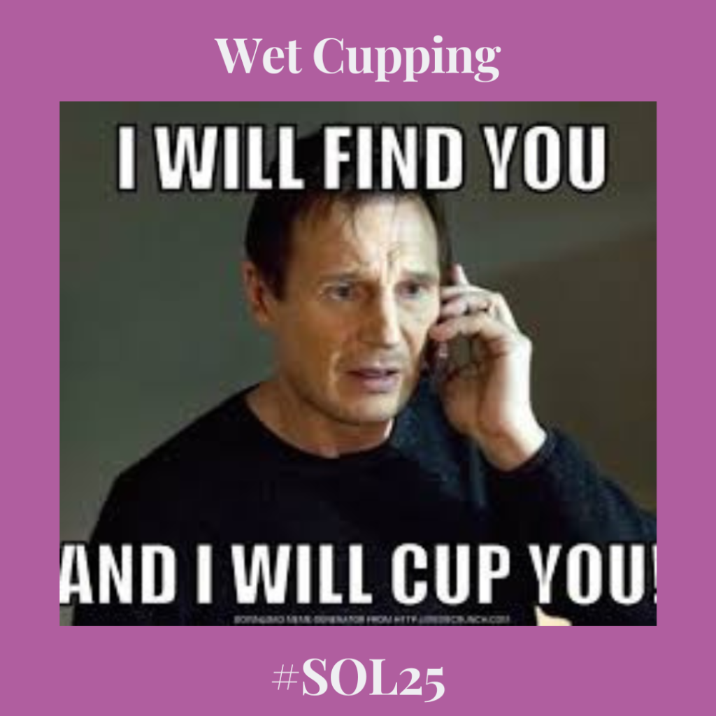sol25 cupping